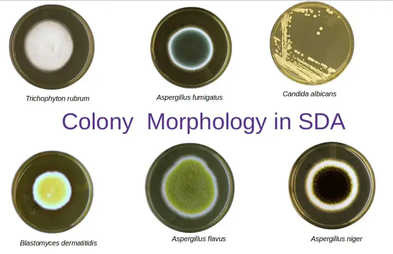 SDA琼脂中的各种真菌菌落