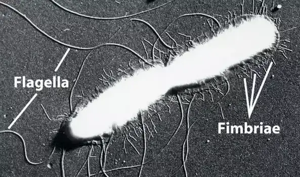 伤寒沙门氏菌的电子显微照片显示鞭毛和阴毛